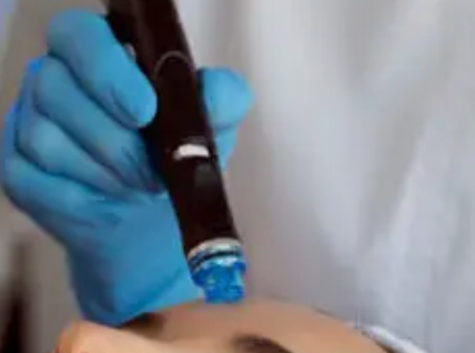 Hidratación facial intradermica