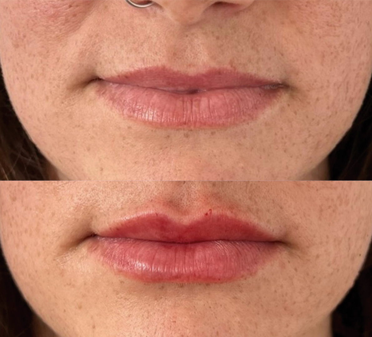 Hidratación labial