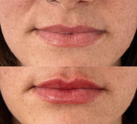 Hidratación labial
